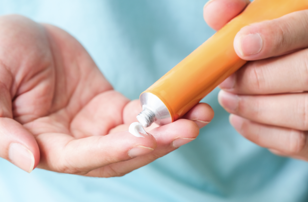 脂漏性皮膚炎の治療薬（外用薬チューブ）